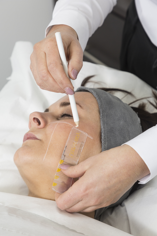 Laser + Skin Clinics Athlone tattoo work 6