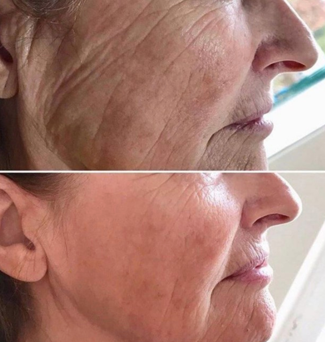 Laser + Skin Clinics Athlone studio space